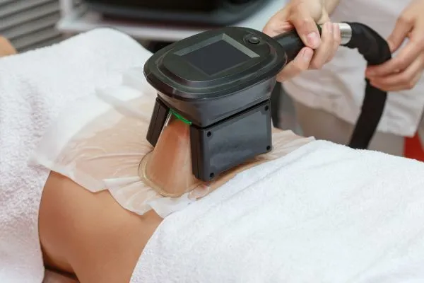 Image of person having fat freezing treatment to help weight gain Harrow