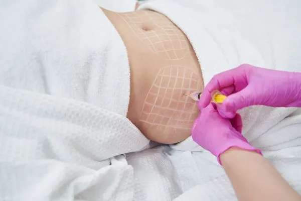 image of fat dissolving injections on love handles to help combat weight gain Harrow