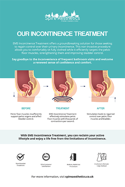 image of how urge incontinence Harrow treatment works