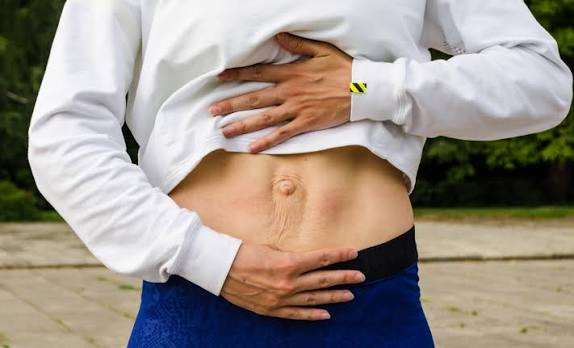 When Could Diastasis Recti Be the Missing Piece of the Puzzle Harrow?